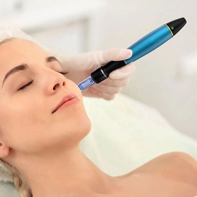 Microneedling in Dubai