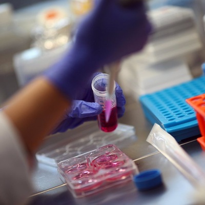 Stem Cell Therapy for Hair in Dubai