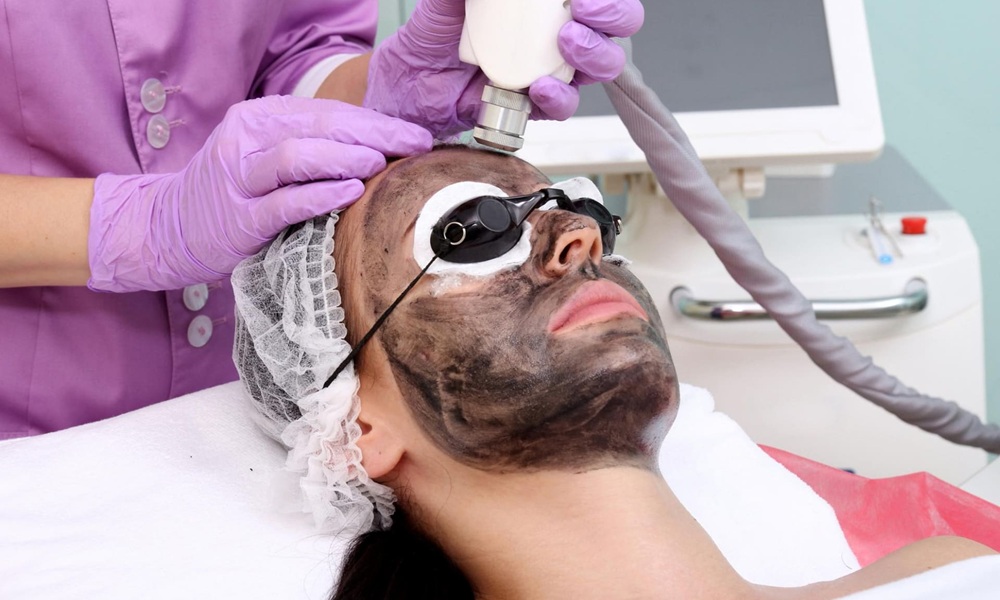 Carbon Laser Peel for Pigmentation Treatment in Dubai
