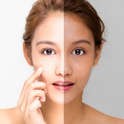 Key Facts You Should Know About Skin Whitening