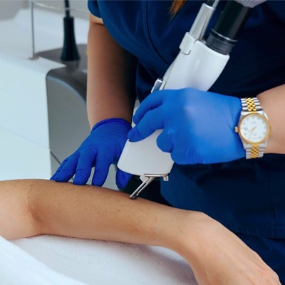 Laser Hair Removal Clinic in Dubai