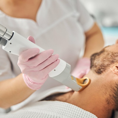 Men’s Beard Line Laser Hair Removal in Dubai