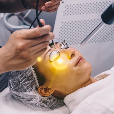 Spectra Hollywood Laser Peel in Dubai