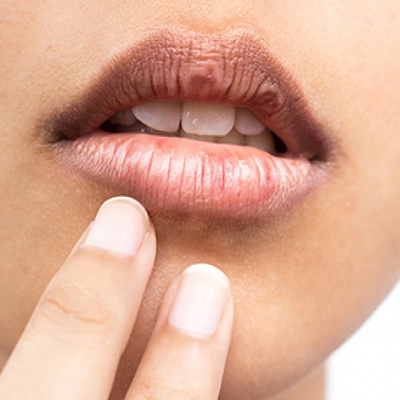 Dark Lips Treatment by Dermatologist