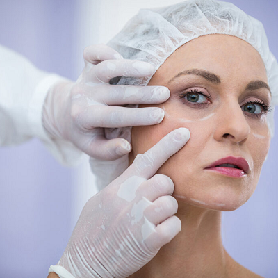 How to Fix Uneven Skin Tone with a Dermatologist’s Help