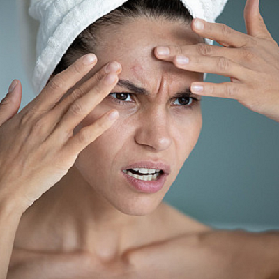 can stress cause skin problems
